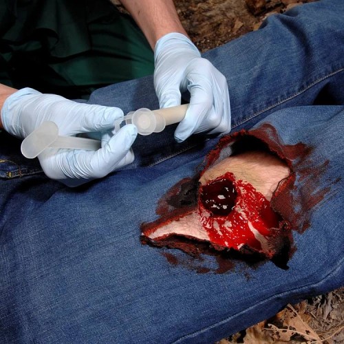 Аппликатор гемостатический с гранулами Rhino Rescue в Ельце хитозановый